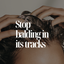 Stop Balding in Its Tracks, Hair Growth Products Available at ByErim